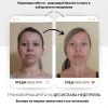 Face Yoga Box
